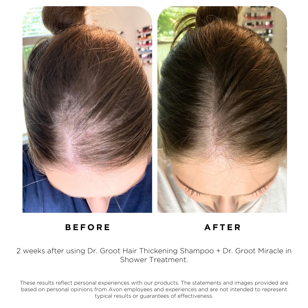 โจSALE! โจBuy two or more and get 15% OFF! ๐ฅ At-Home & On-the-Go Solution for Hair Thinning