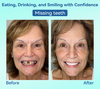 Tiworld®🍀𝐏𝐫𝐞𝐦𝐢𝐮𝐦 𝐃𝐞𝐧𝐭𝐮𝐫𝐞(🦷𝐋𝐢𝐦𝐢𝐭𝐞𝐝 𝐭𝐢𝐦𝐞 𝐝𝐢𝐬𝐜𝐨𝐮𝐧𝐭 𝐋𝐚𝐬𝐭 𝟑𝟎 𝐦𝐢𝐧𝐮𝐭𝐞𝐬🦷)