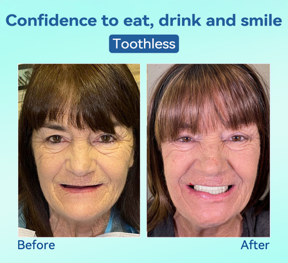 Tiworld®🍀𝐏𝐫𝐞𝐦𝐢𝐮𝐦 𝐃𝐞𝐧𝐭𝐮𝐫𝐞(🦷𝐋𝐢𝐦𝐢𝐭𝐞𝐝 𝐭𝐢𝐦𝐞 𝐝𝐢𝐬𝐜𝐨𝐮𝐧𝐭 𝐋𝐚𝐬𝐭 𝟑𝟎 𝐦𝐢𝐧𝐮𝐭𝐞𝐬🦷)