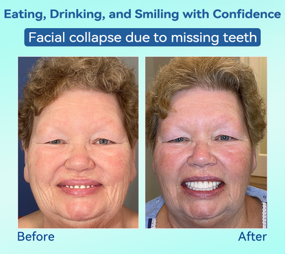 Tiworld®🍀𝐏𝐫𝐞𝐦𝐢𝐮𝐦 𝐃𝐞𝐧𝐭𝐮𝐫𝐞(🦷𝐋𝐢𝐦𝐢𝐭𝐞𝐝 𝐭𝐢𝐦𝐞 𝐝𝐢𝐬𝐜𝐨𝐮𝐧𝐭 𝐋𝐚𝐬𝐭 𝟑𝟎 𝐦𝐢𝐧𝐮𝐭𝐞𝐬🦷)