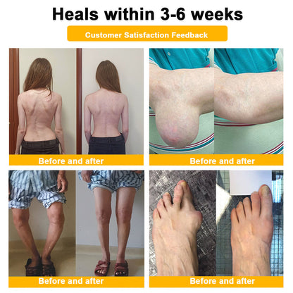 🎁Flash Sale - ODALIT™ Botulinum Toxin & Bee Venom Pain-Relief Bone Healing Cream 🐝💎