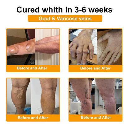 🎁Flash Sale - ODALIT™ Botulinum Toxin & Bee Venom Pain-Relief Bone Healing Cream 🐝💎