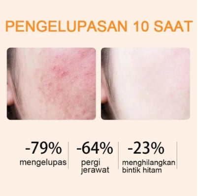 [Final DAY 84%OFF]🔥Orange Enzyme Exfoliating Gel — The Gentle Miracle Your Skin Has Been Crying Out For