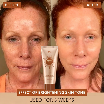 Whitening & Spot-Removing Mask – 👩‍⚕️ Natural Ingredients for Age Spots, Freckles, and Sun Spots