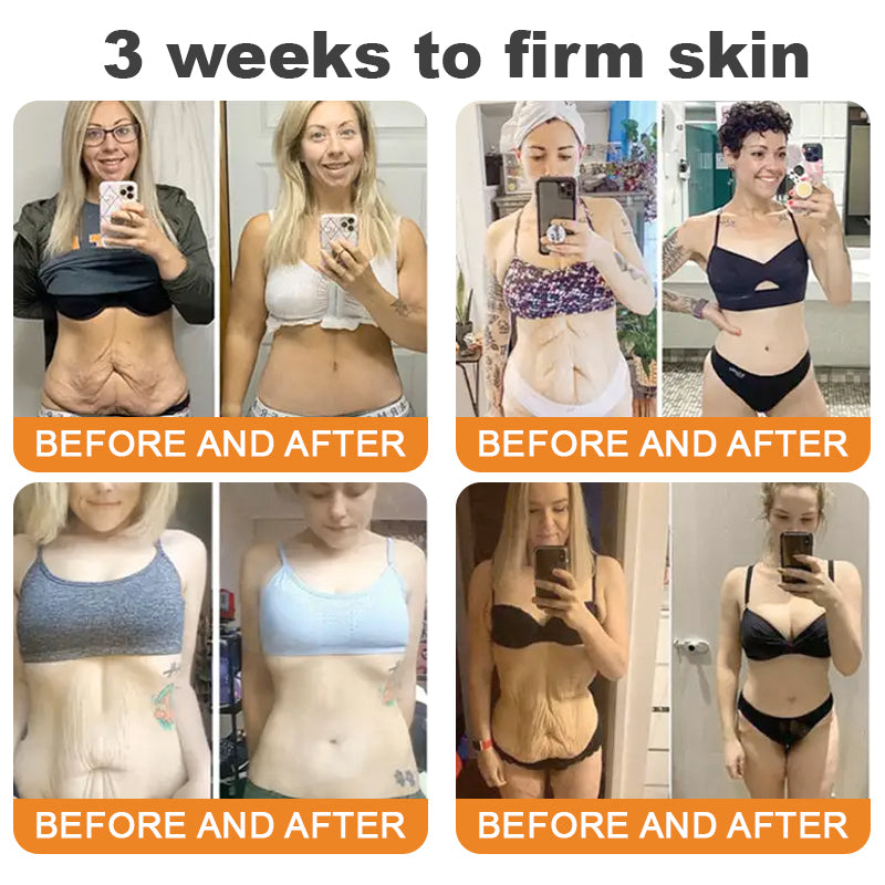 Made and Shipped from Australia 🥑 LipMaps® Bee Venom Skin Restoration Cream ⏰ LAST DAY 80% OFF