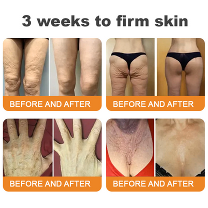 Made and Shipped from Australia 🥑 LipMaps® Bee Venom Skin Restoration Cream ⏰ LAST DAY 80% OFF