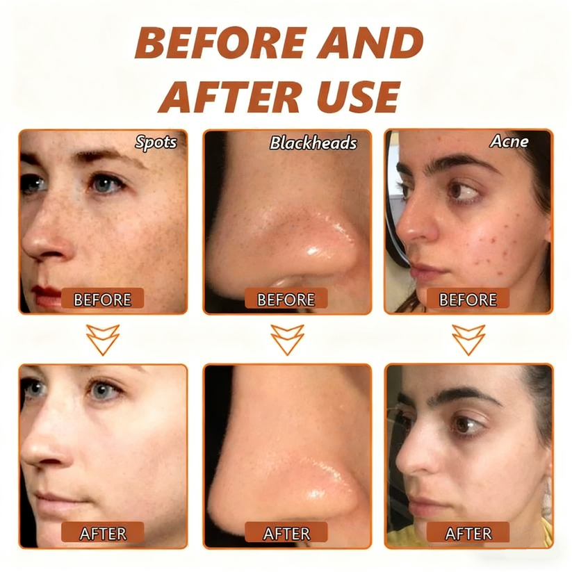 Whitening & Spot-Removing Mask – 👩‍⚕️ Natural Ingredients for Age Spots, Freckles, and Sun Spots