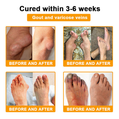 🎁Flash Sale - ODALIT™ Botulinum Toxin & Bee Venom Pain-Relief Bone Healing Cream 🐝💎