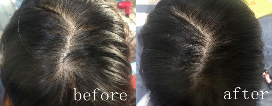 🔥 Lovilds® Hair Restoration Spray ( Reawaken Your Roots. Regrow Naturally. ✨ Clinically Proven Hair Regrowth Within 4 weeks✨)