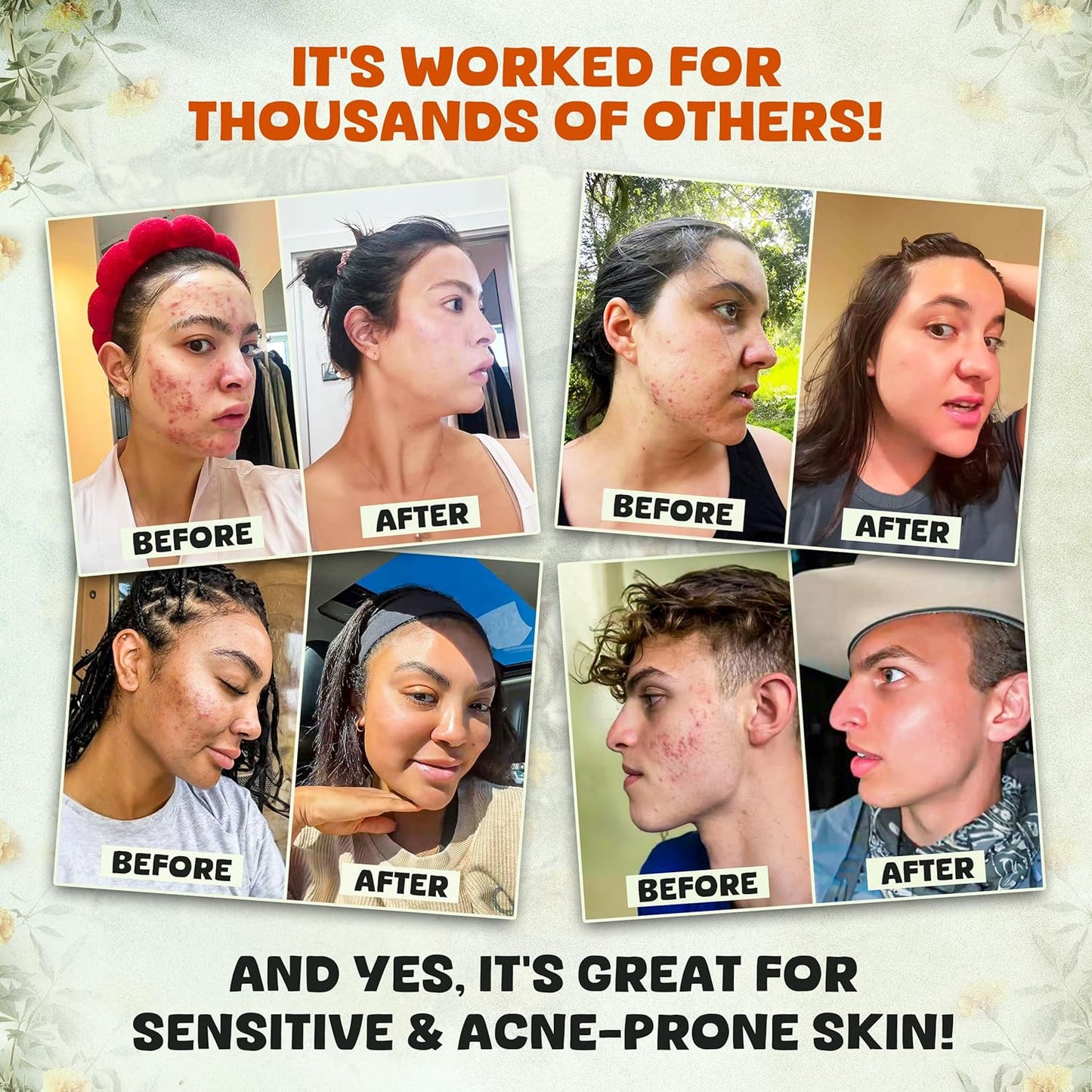 ✨ Daily Sale! ✨ Whipped Beef Tallow and Honey Balm Moisturizer