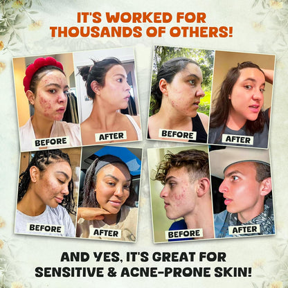 ✨ Daily Sale! ✨ Whipped Beef Tallow and Honey Balm Moisturizer