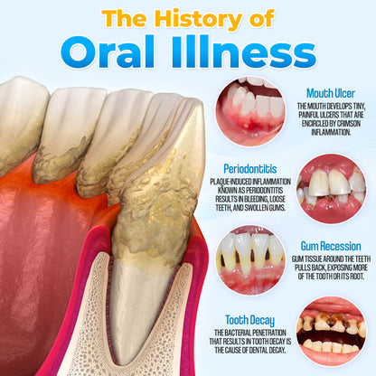 🐝 ODEIUN™ MicroSmile Bee Venom Gum Repair Mousse + Tongue Scraper 🦷