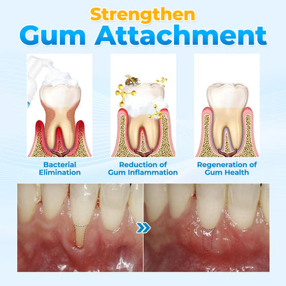 🐝 ODEIUN™ MicroSmile Bee Venom Gum Repair Mousse + Tongue Scraper 🦷