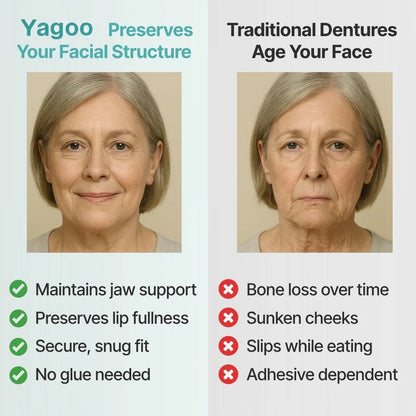 🌎Ends Today: 70% OFF! ⏰Yagoo™ Medical Full Denture with Strong Suction