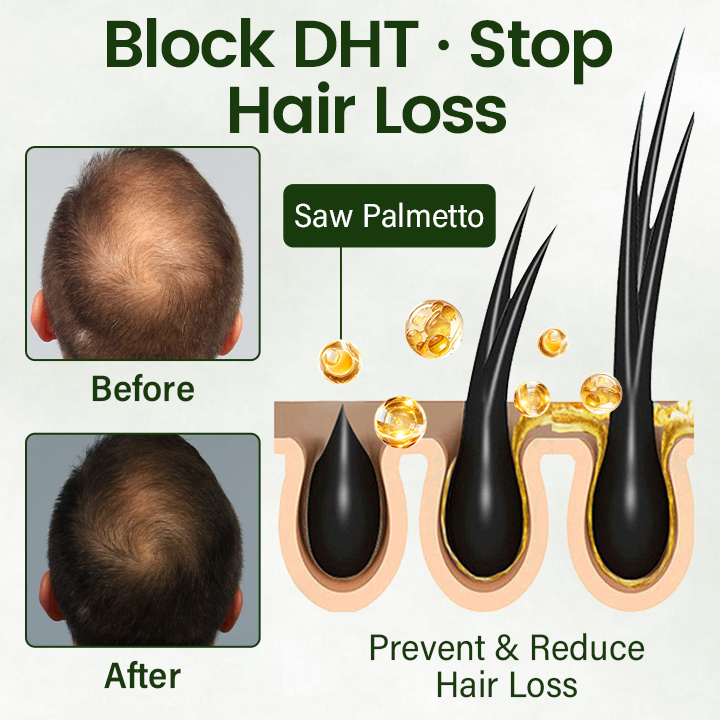 🔥 Lovilds® Hair Restoration Spray ( Reawaken Your Roots. Regrow Naturally. ✨ Clinically Proven Hair Regrowth Within 4 weeks✨)