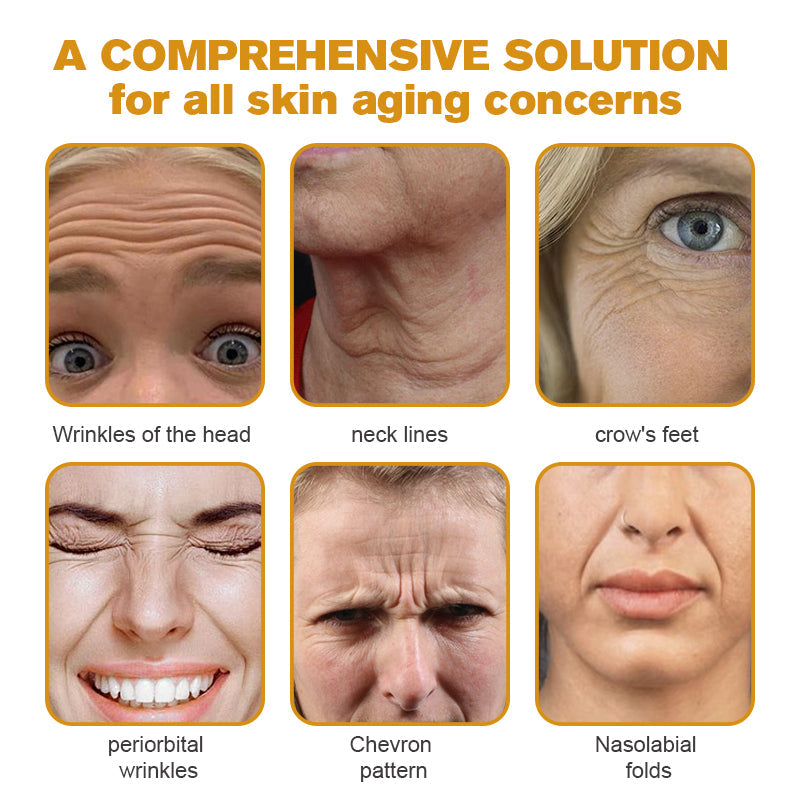 (🐝Made and Shipped from UK✅) Rekulo™ Botox Bee Venom Wrinkle Removal Cream- LAST DAY 70% OFF